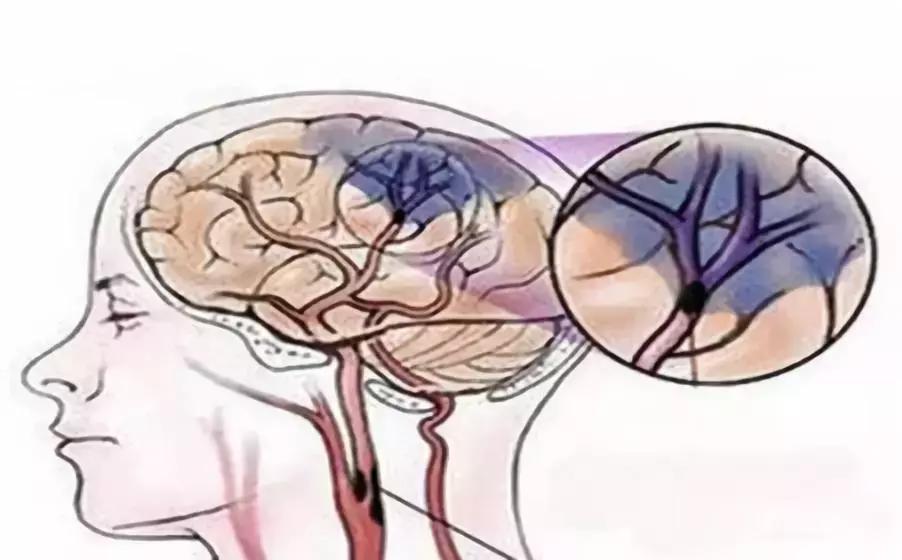 最新胃癱癥狀解析與應(yīng)對(duì)方法